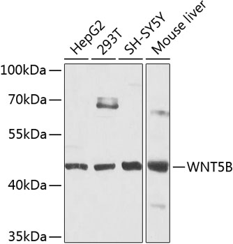 Anti-Protein Wnt-5b Polyclonal Antibody (CAB8313)