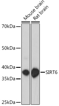 Anti-SIRT6 Antibody (CAB18468)