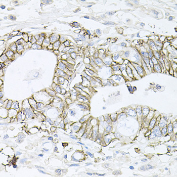 Anti-ATP1B1 Antibody (CAB5793)