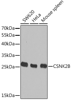 Anti-CSNK2B Antibody (CAB17467)