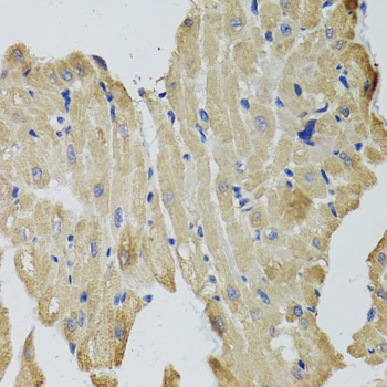 Anti-CKMT2 Polyclonal Antibody (CAB8088)