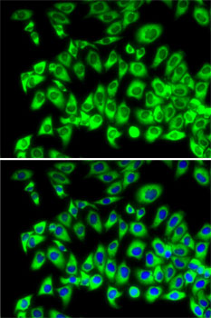 Anti-RPL13 Antibody (CAB4083)