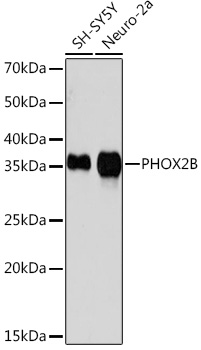 Anti-PHOX2B Antibody (CAB6816)