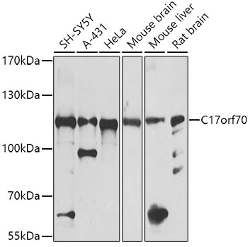 Anti-C17orf70 Polyclonal Antibody (CAB8591)