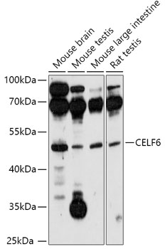 Anti-CELF6 Antibody (CAB17748)