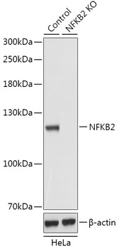 [KO Validated] NF-kB2 Rabbit Polyclonal Antibody (CAB18039)