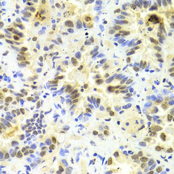 Anti-SRSF1 Antibody (CAB1649)