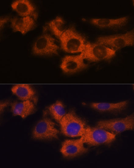 Anti-NDRG4 Antibody (CAB16195)