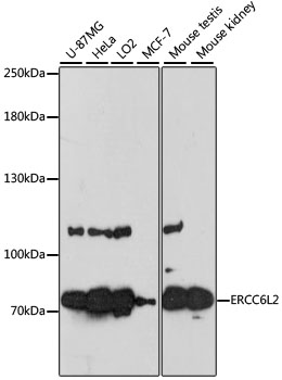 Anti-ERCC6L2 Antibody (CAB13144)