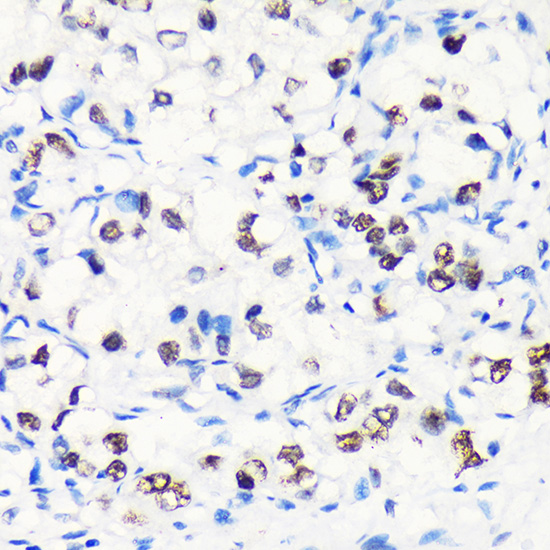 Anti-MYEF2 Antibody (CAB15829)