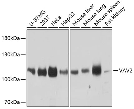 Anti-VAV2 Polyclonal Antibody (CAB9483)
