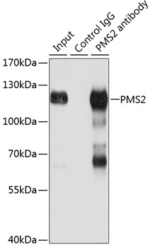Anti-PMS2 Antibody (CAB13680)