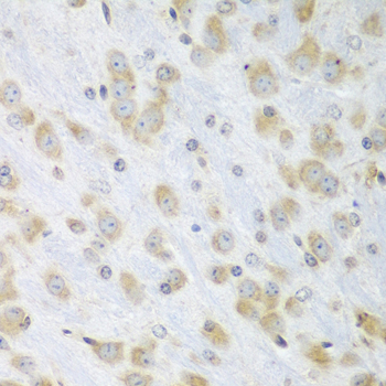 Anti-PDIA3 Antibody (CAB1085)