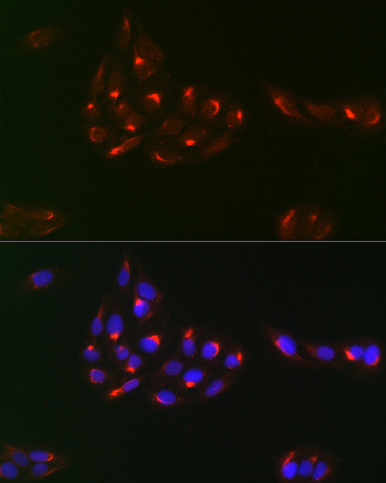 Anti-PDGFRA Antibody (CAB2103)