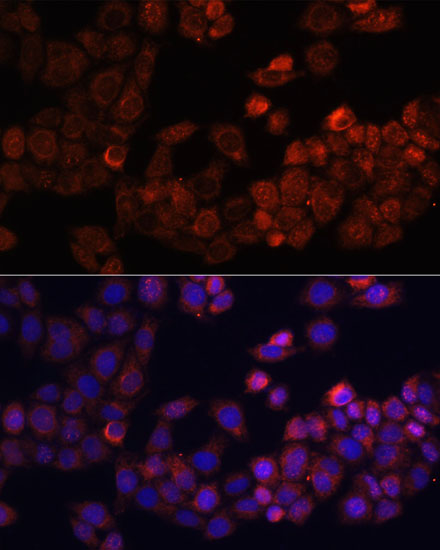 Anti-FAK Antibody (CAB11195)