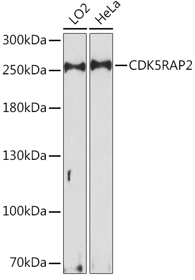 Anti-CDK5RAP2 Antibody (CAB15476)