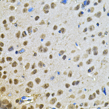 Anti-PPID Antibody (CAB6949)