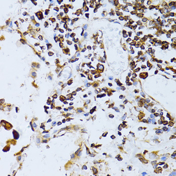 Anti-TAPBP Antibody (CAB13357)