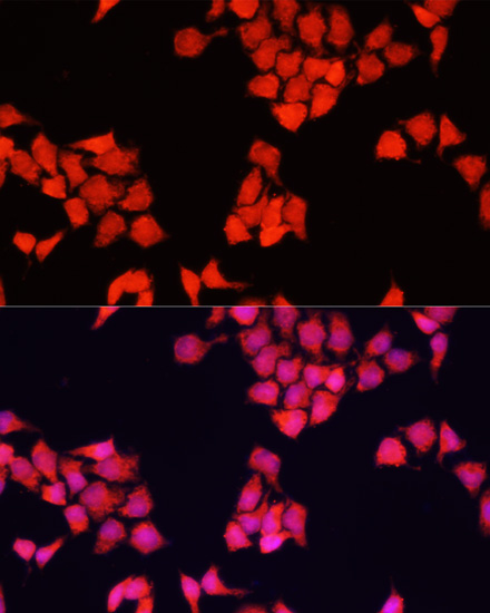 Anti-FXR1 Antibody (CAB16447)