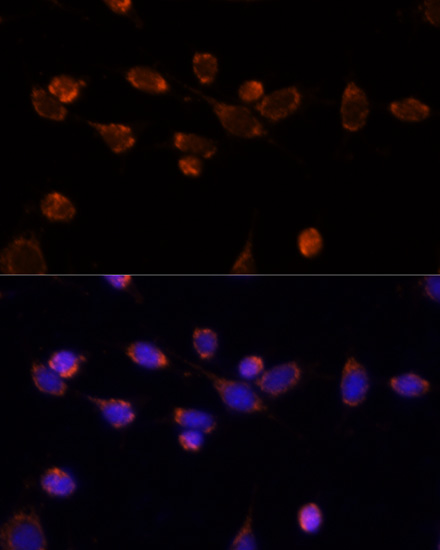 Anti-PDHA1 Antibody (CAB17432)