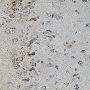 Anti-MAPK11 Antibody (CAB7717)