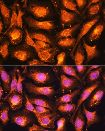 Anti-DRP1 Antibody [KO Validated] (CAB17069)