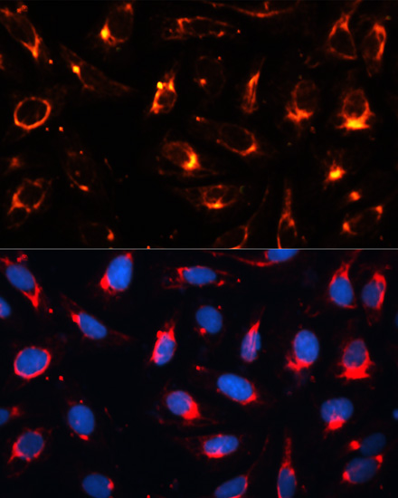 Anti-Cytokeratin-18 Antibody (CAB1022)