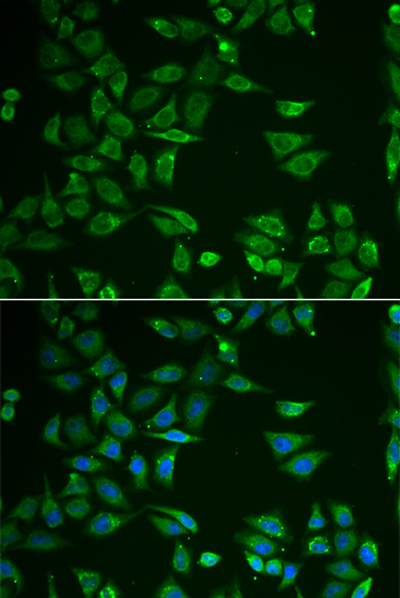 Anti-ST3GAL4 Antibody (CAB6309)