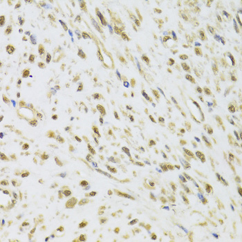 Anti-DDX1 Antibody (CAB6575)