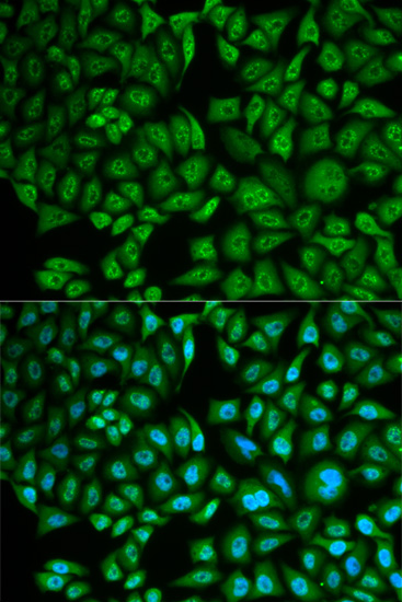 Anti-CTSA Antibody (CAB5503)