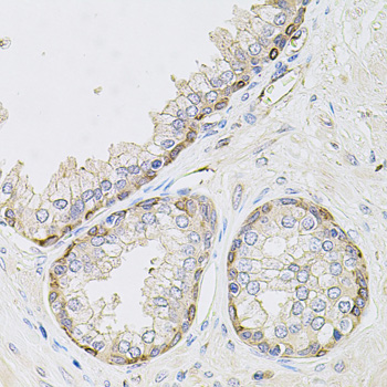 Anti-CIB1 Antibody (CAB4430)