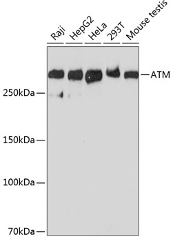 Anti-ATM Antibody (CAB19650)