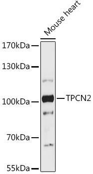 Western blot analysis of extracts of Mouse heart, using TPCN2 antibody at 1:1000 dilution. Secondary antibody: HRP Goat Anti-Rabbit IgG (H+L) at 1:10000 dilution. Lysates/proteins: 25ug per lane. Blocking buffer: 3% nonfat dry milk in TBST. Detection: ECL Enhanced Kit. Exposure time: 300s.