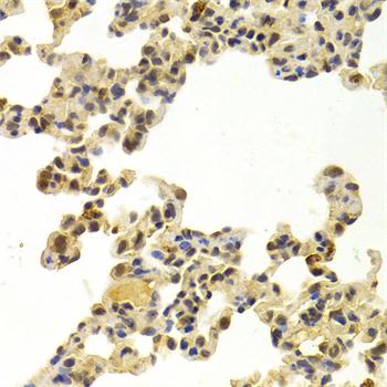 Anti-CDK6 Antibody (CAB3165)