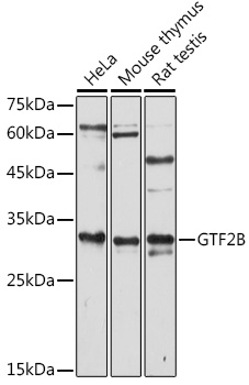 Anti-GTF2B Antibody (CAB1708)