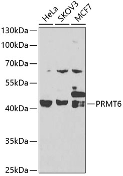 Anti-PRMT6 Antibody [KO Validated] (CAB7814)