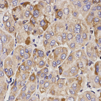 Anti-GAS2 Antibody (CAB1168)