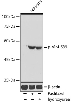 Anti-Phospho-VIM-S39 pAb (CABP0806)