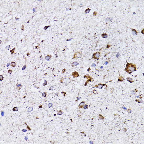 Anti-RARA Antibody (CAB0370)