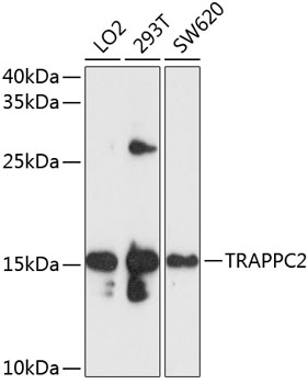 Anti-TRAPPC2 Antibody (CAB10465)