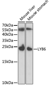 Anti-LY86 Antibody (CAB6185)