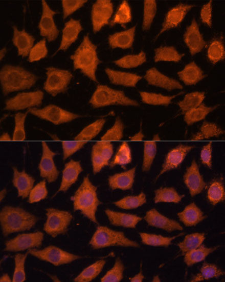 Anti-LGMN Antibody (CAB10570)