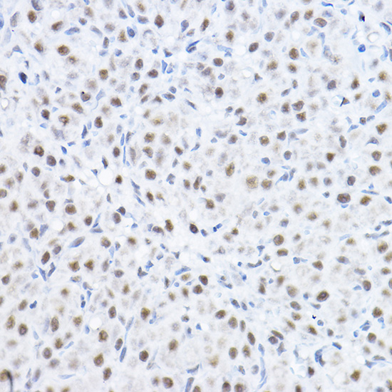 Anti-SMEK1 Polyclonal Antibody (CAB8500)