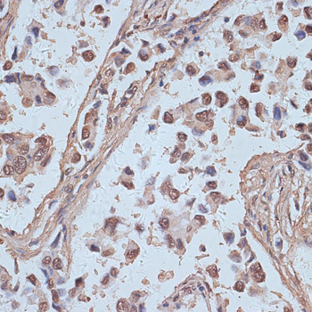 Anti-SNW1 Antibody (CAB14580)