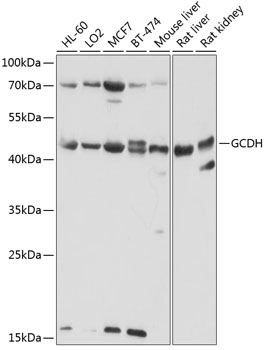 Anti-GCDH Polyclonal Antibody (CAB9057)