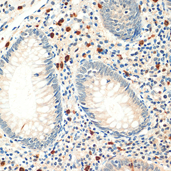 Anti-FOXP3 Polyclonal Antibody (CAB8024)