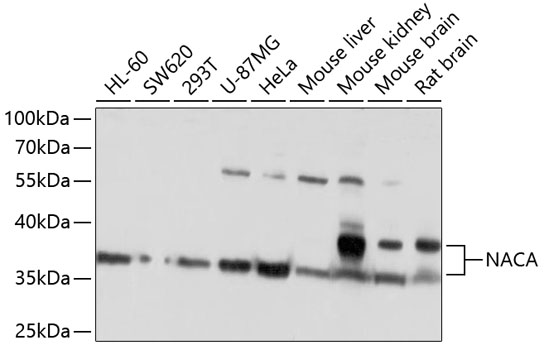 Anti-NACA Antibody (CAB10122)