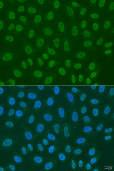 Anti-LSM2 Polyclonal Antibody (CAB7988)