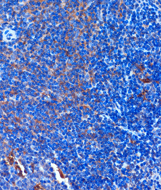 Anti-TCIRG1 Antibody (CAB15382)