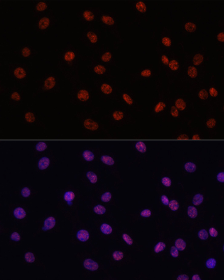 Anti-MYCT1 Antibody (CAB14541)